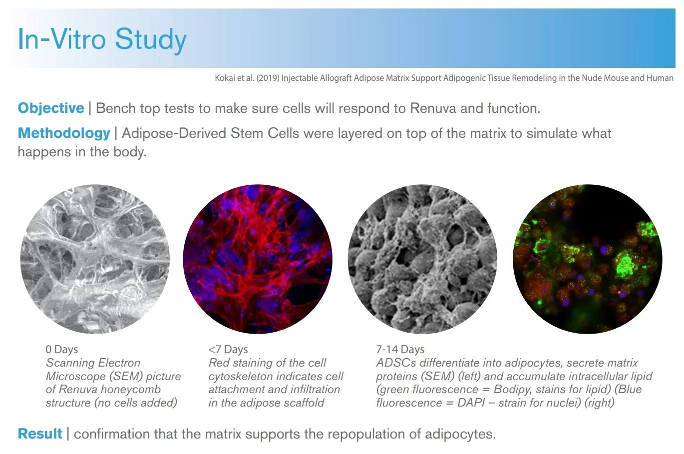 Renuva Nonsurgical Fat Transfer Seattle Bellevue Sammamish