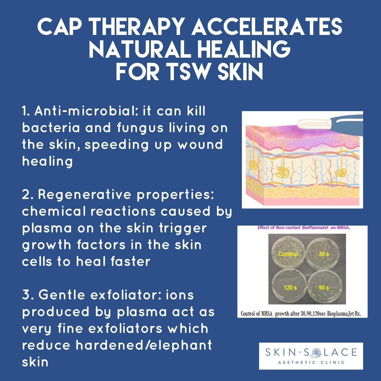 ⚡️ The benefits of our Ultra Pulse Contact CAP for TSW skin ⚡️