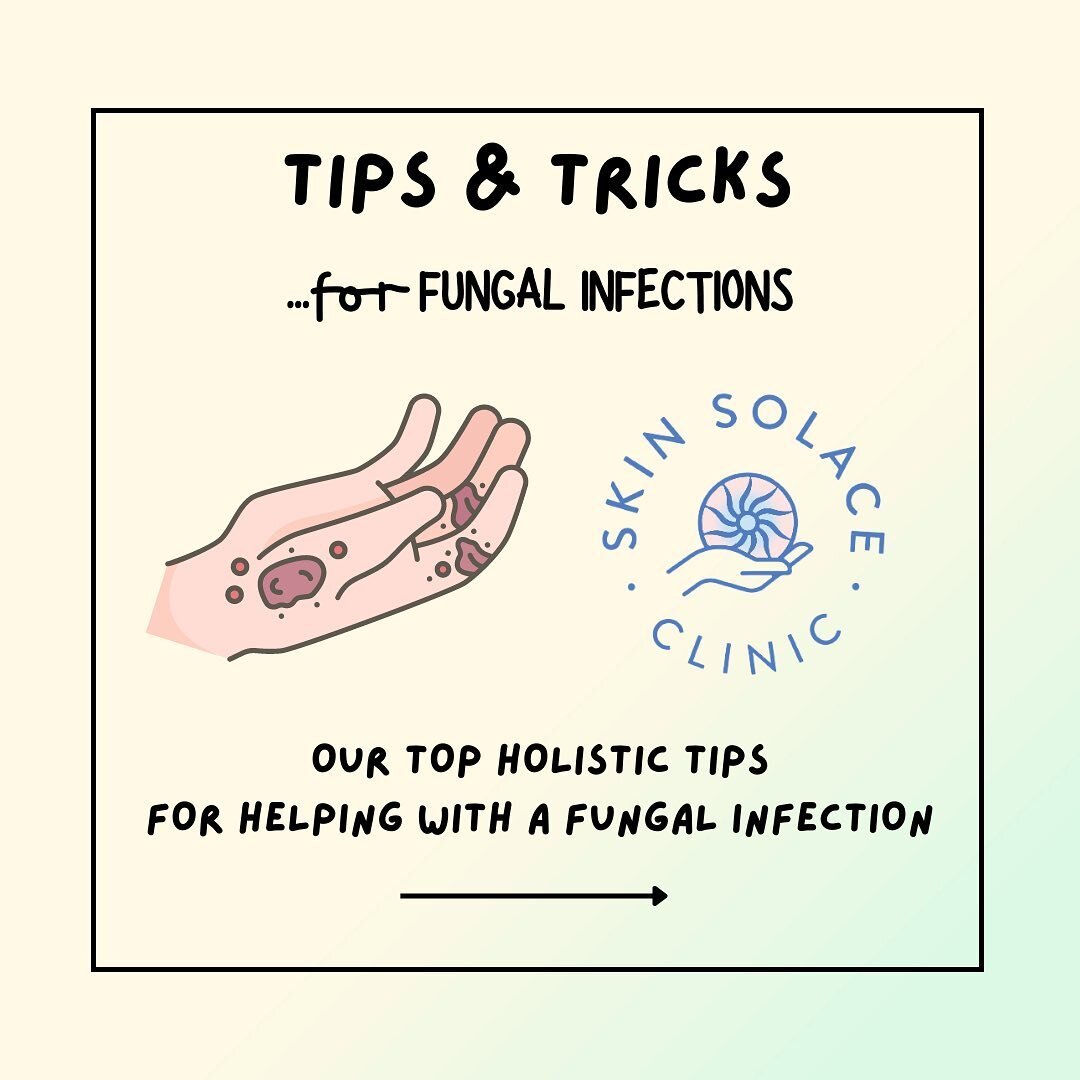 Our Top Fungal Infection + TSW Tips ⭐️