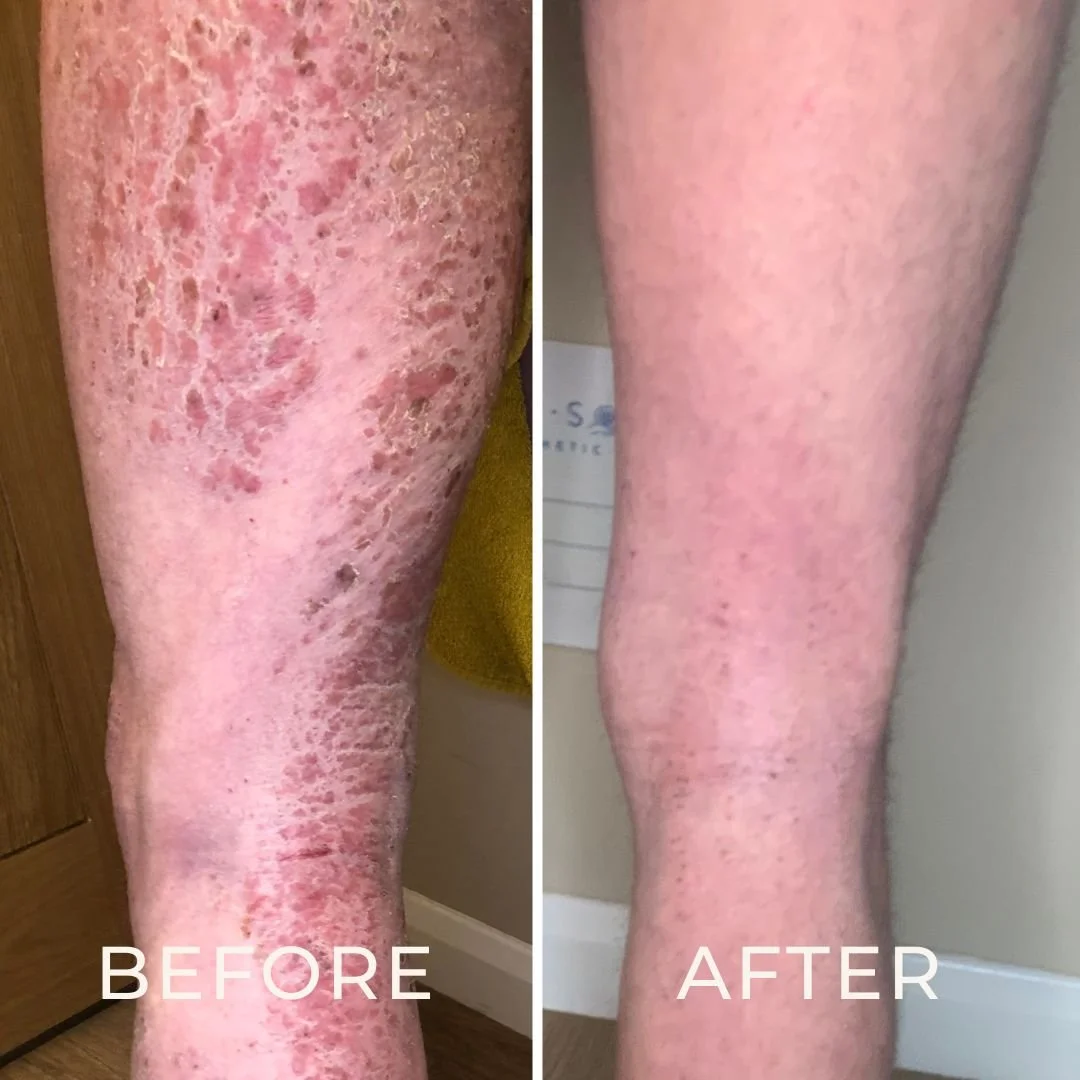 Skin Solace Clinic for TSW