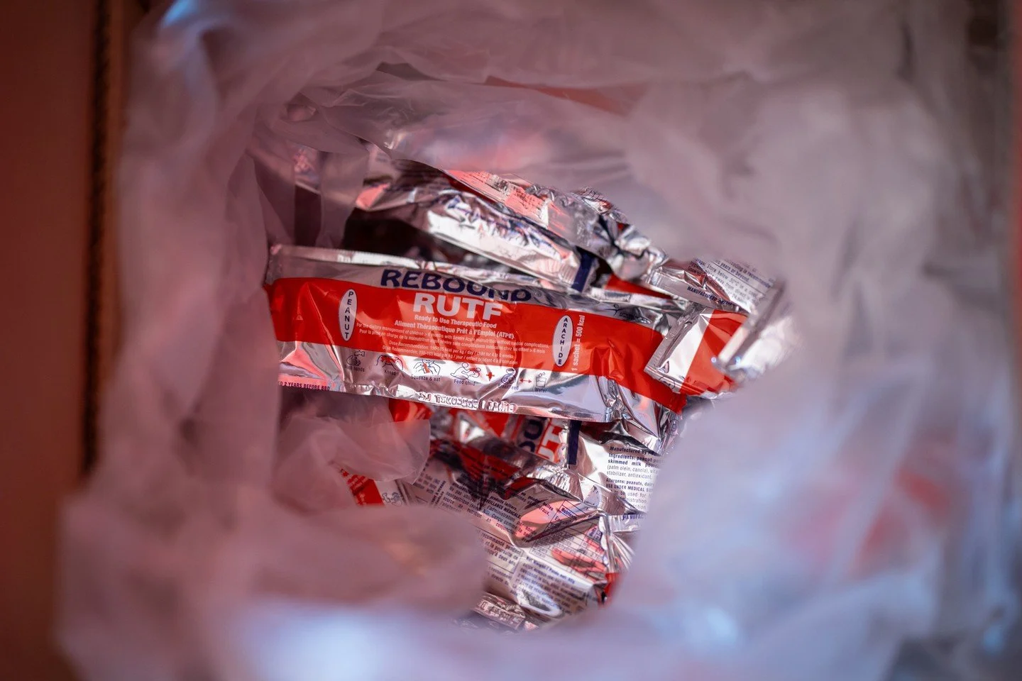 Ready-to-Use Therapeutic Food (RUFT) is a peanut-based paste enriched with vitamins, minerals, sugar, and milk powder used to treat severe acute malnutrition (SAM) in children. We provide it alongside our nutrition plans we have for our severely maln