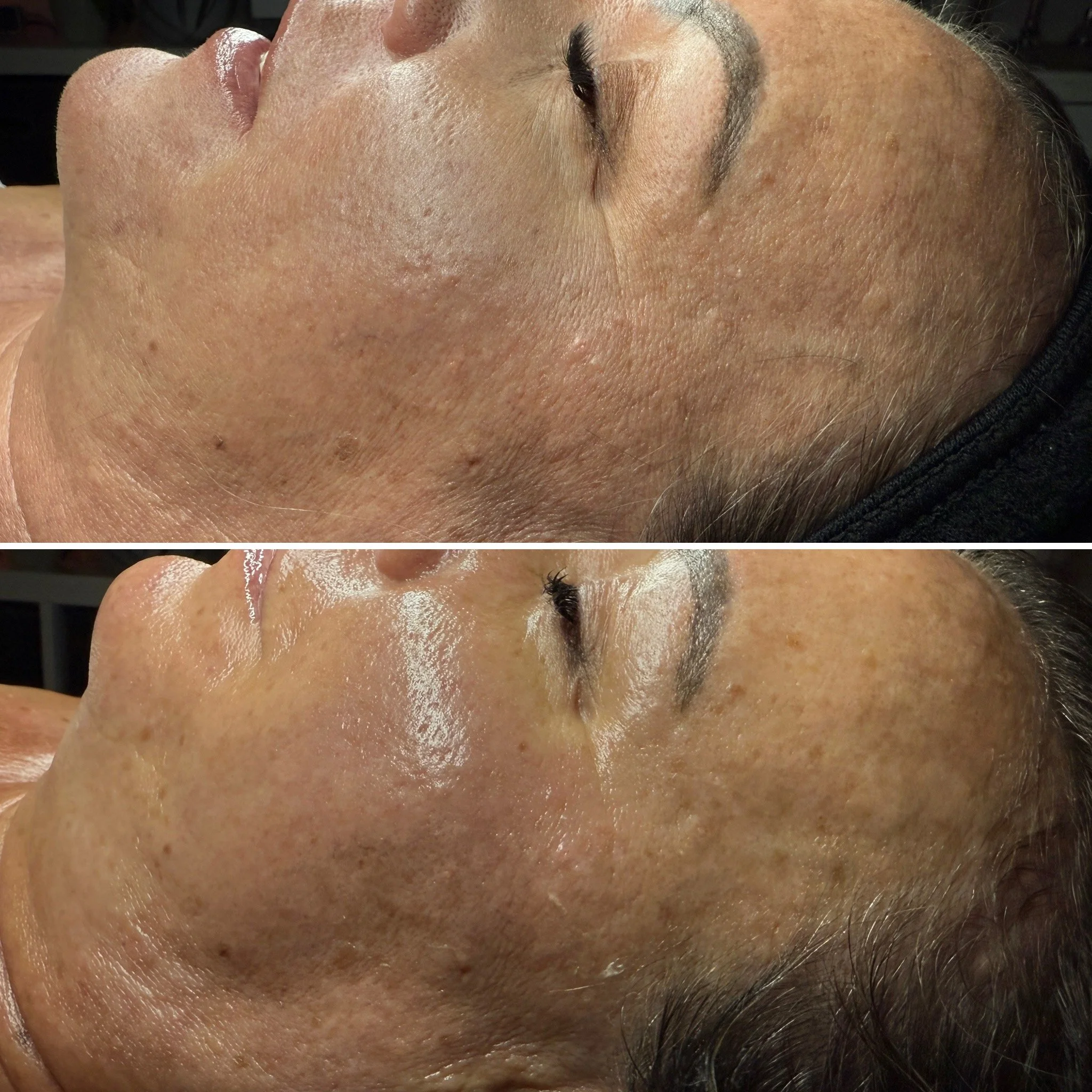 Level 5: The Signature Luxe Facial