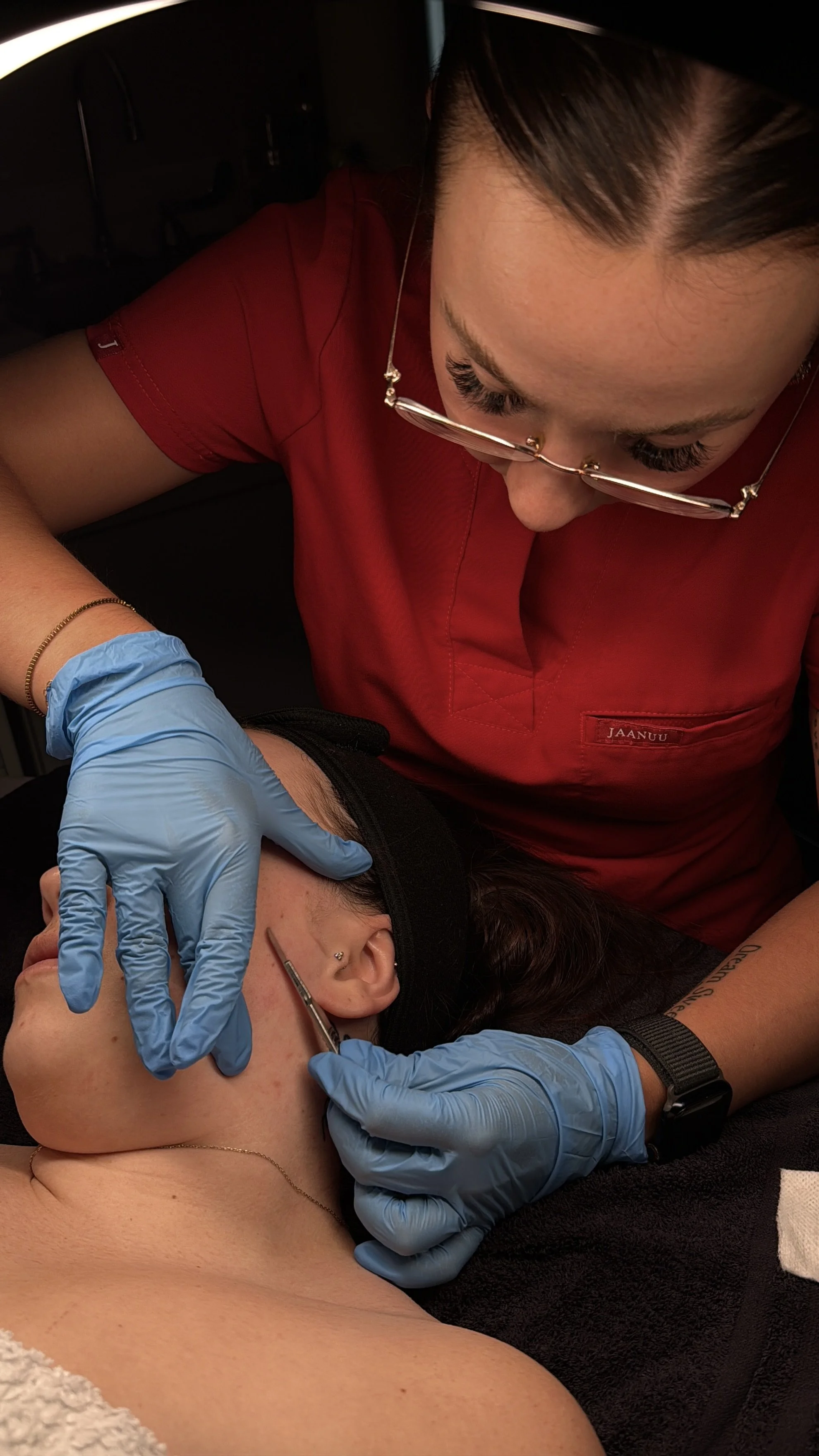 Dermaplaning