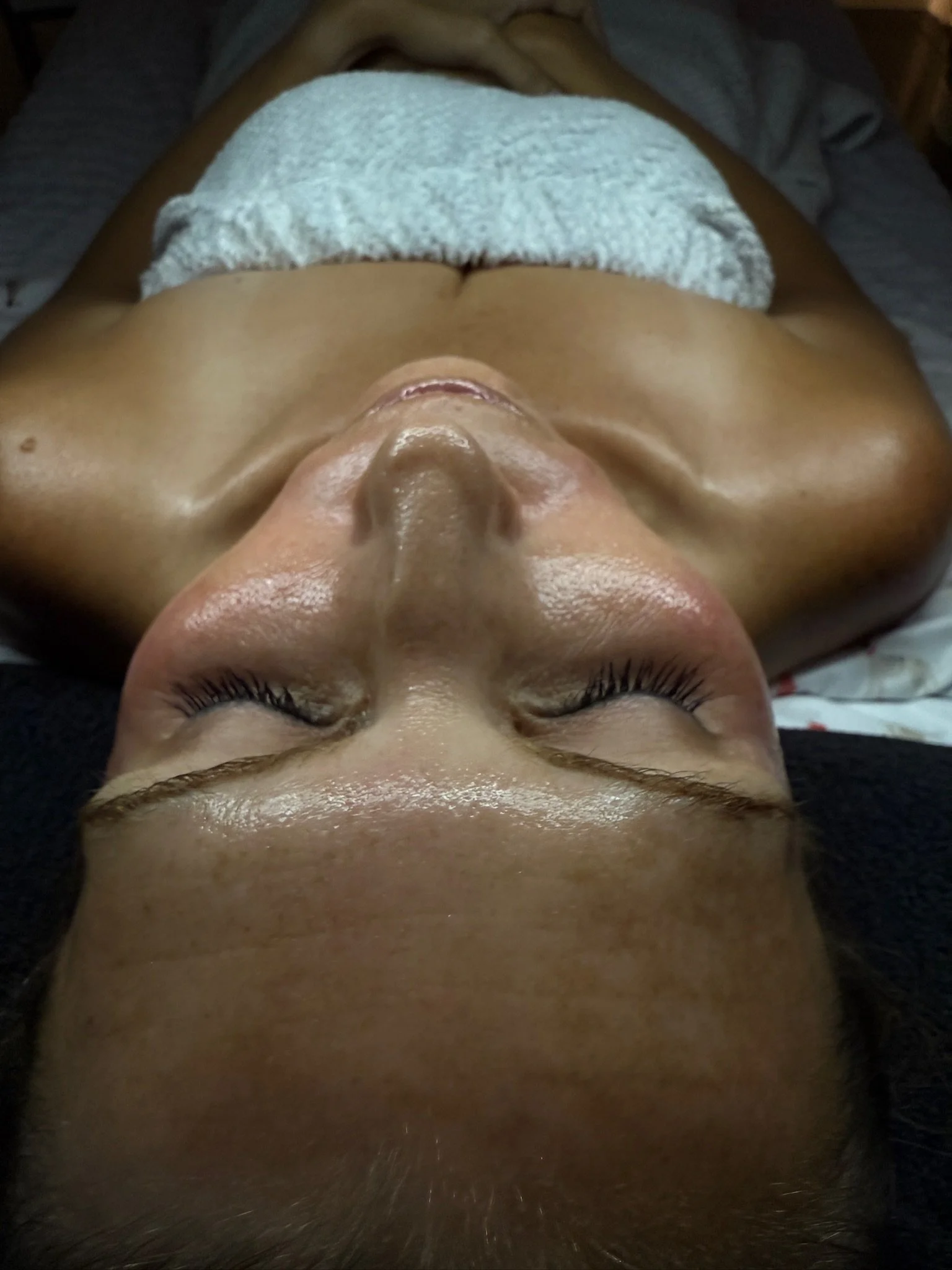 Zemits VerstandHD HydroDiamond™ Service - Post Service Glow