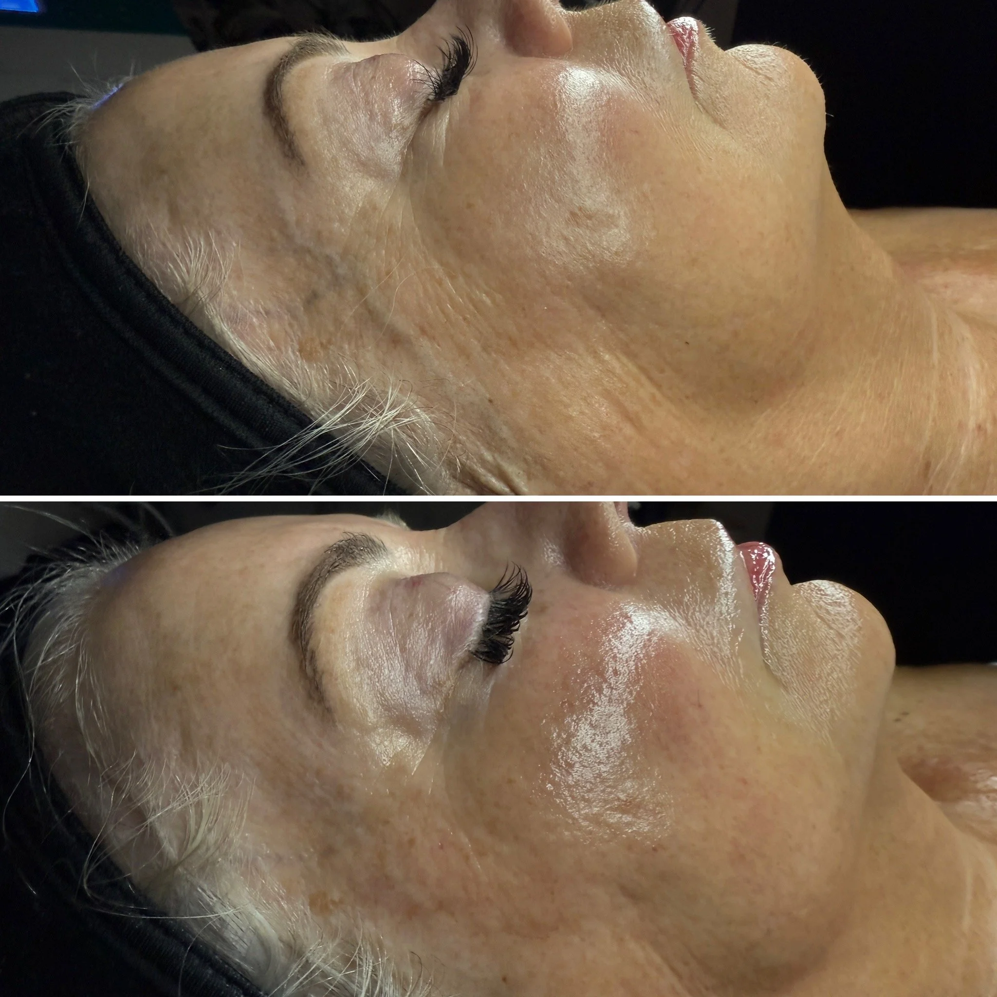 Level 5: The Signature Luxe Facial