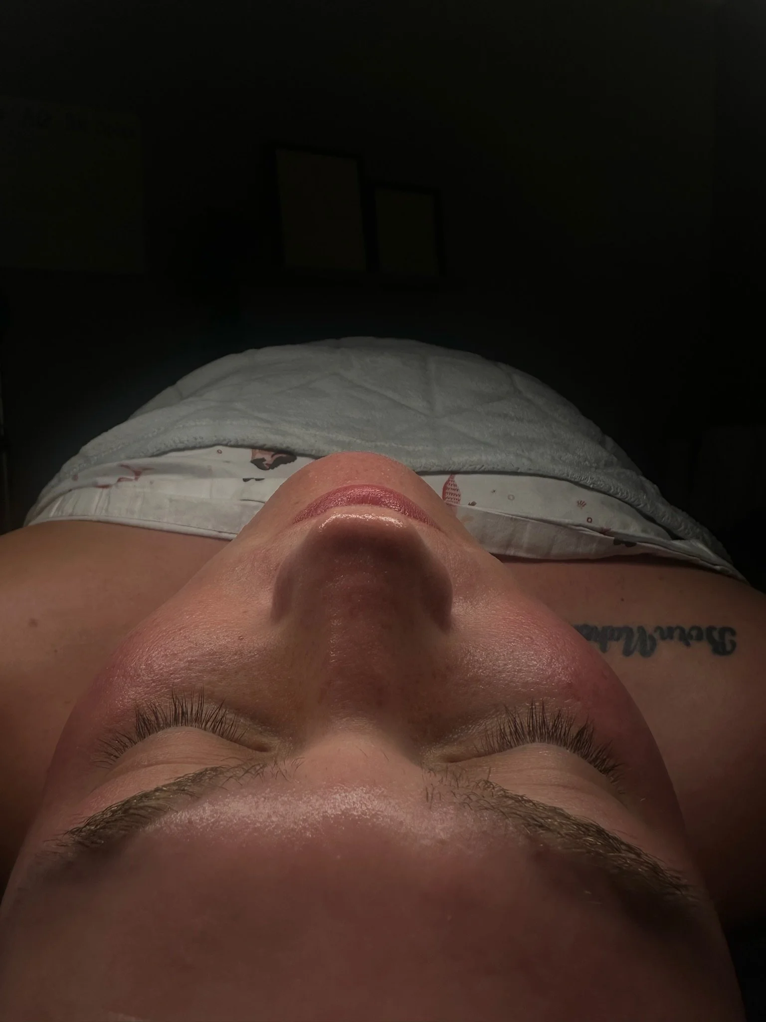 Zemits VerstandHD HydroDiamond™ Service - Post Service Glow