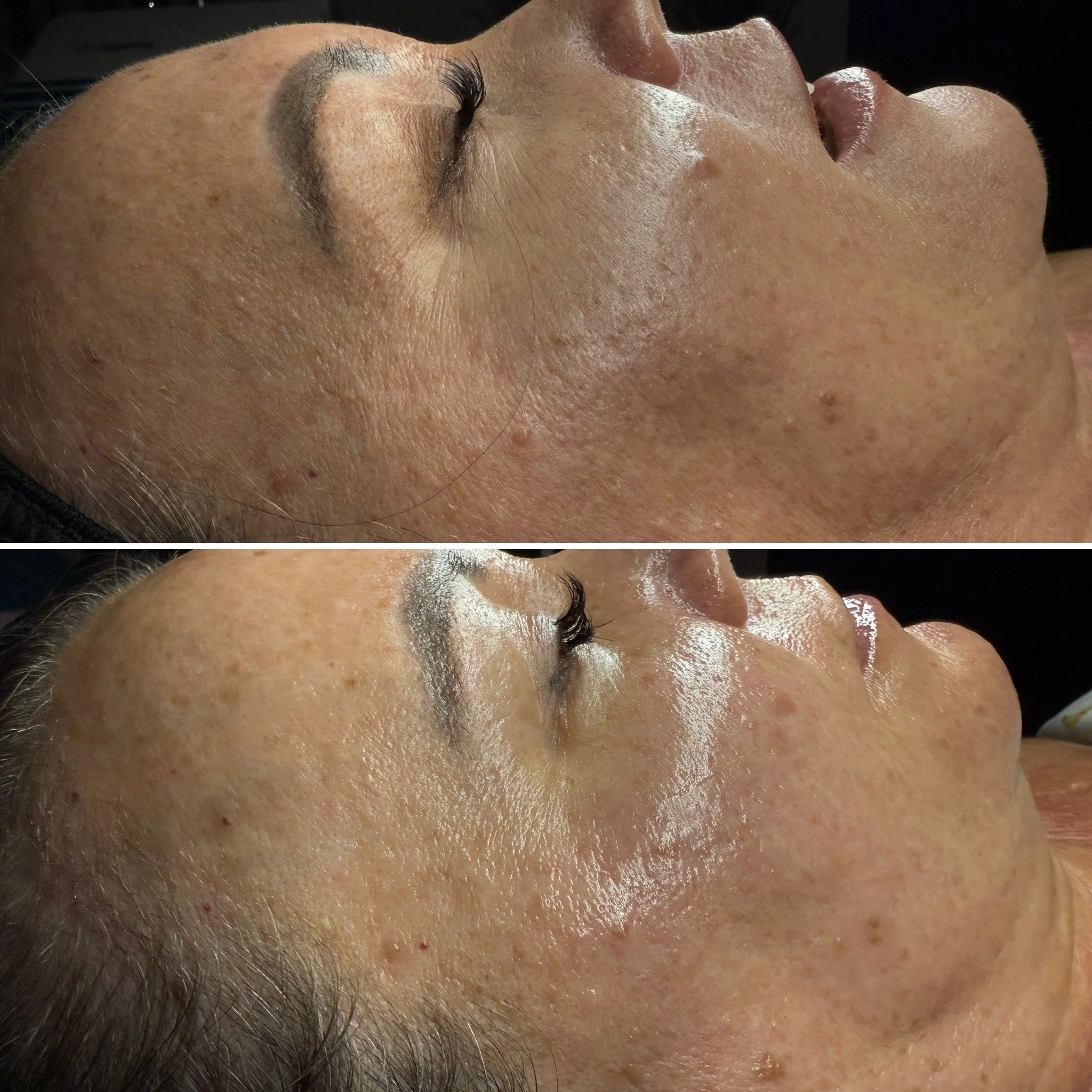 Level 5: The Signature Luxe Facial