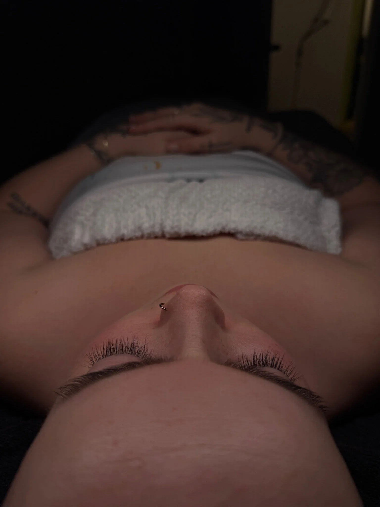 Zemits VerstandHD HydroDiamond™ Service - Post Service Glow
