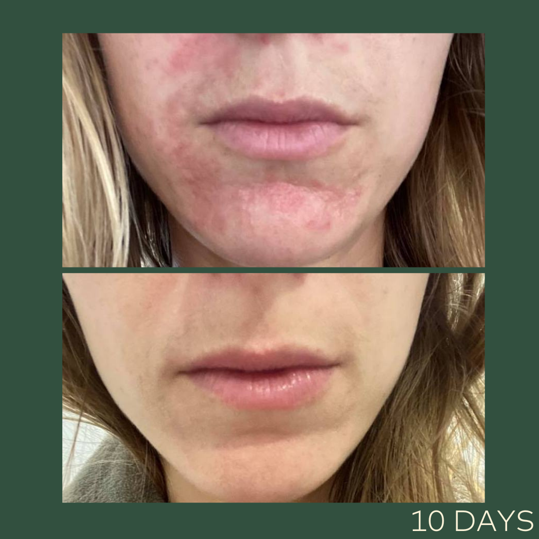 Kōaka Organic Skincare NZ Natural Hemp Oil Products