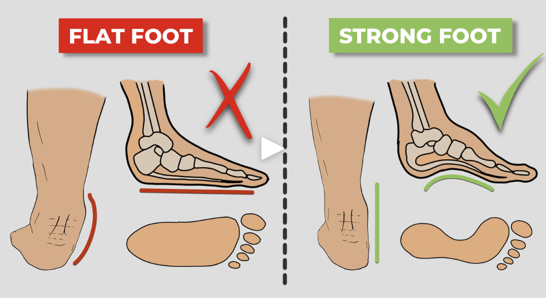 The PATH Rehab & Performance - Benefits of Barefoot Shoes on Foot Health