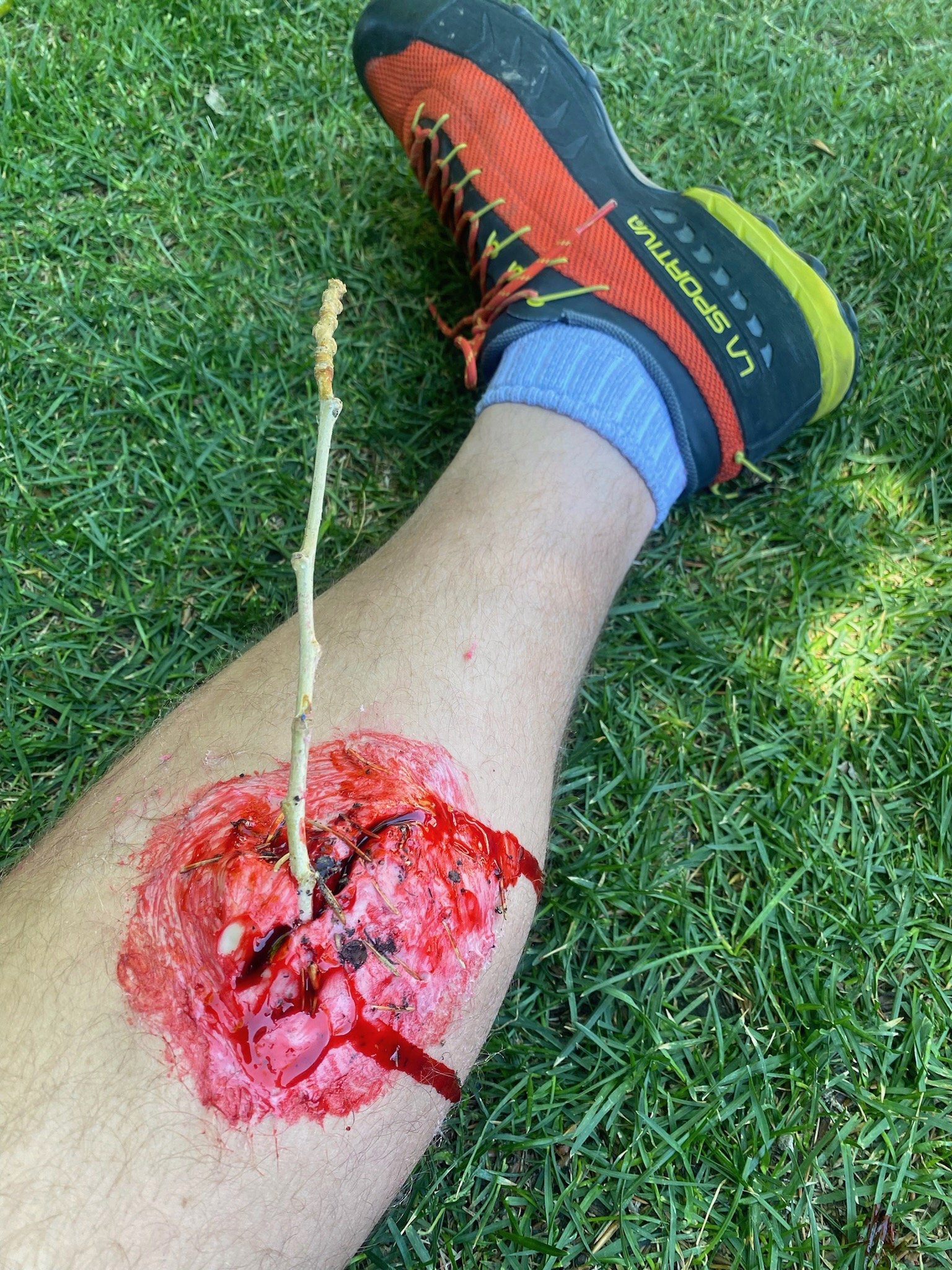 Outdoor photography injury - 2.jpeg
