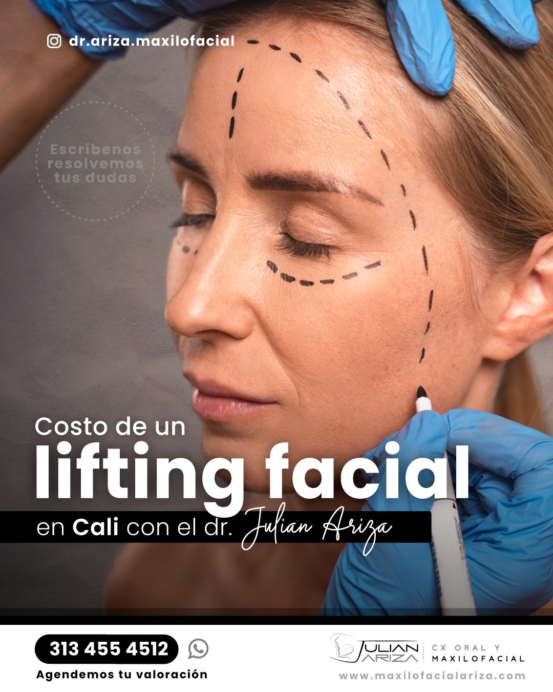 El costo de un lifting facial en Cali var&iacute;a de persona a persona, sin embargo va desde los $20.000.000 Millones de pesos colombianos y $5.000 dolares US. Es fundamental obtener un presupuesto personalizado donde se incluye todos los conceptos 