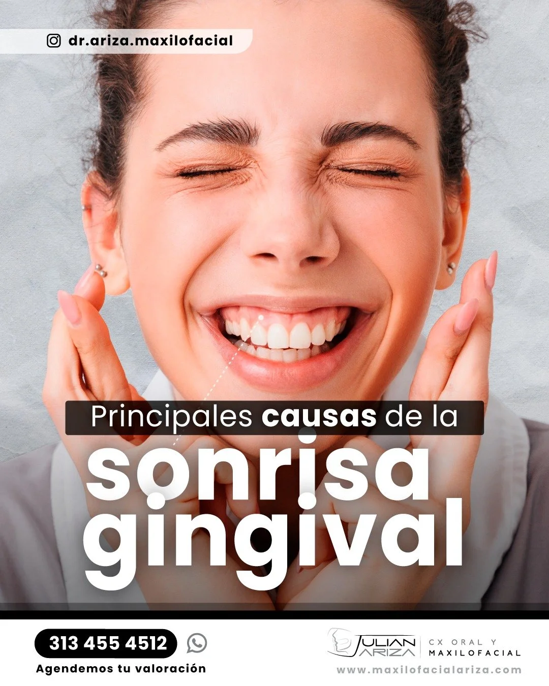 1. Alteraciones en las enc&iacute;as
Exceso de tejido gingival: Las enc&iacute;as cubren m&aacute;s proporci&oacute;n del diente de lo normal 
Erupci&oacute;n pasiva alterada: Los dientes no emergen completamente de las enc&iacute;as durante su desar