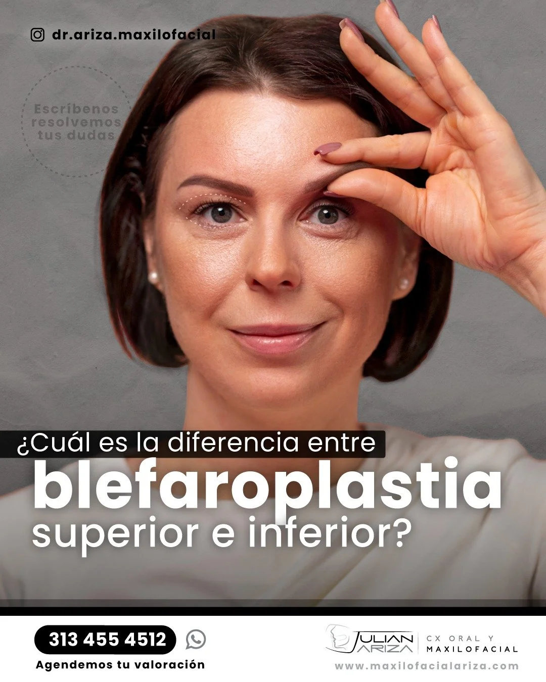 Diferencia entre Blefaroplastia Superior e Inferior
BLEFAROPLASTIA SUPERIOR 👁️⬆️
Zona que trata:
P&aacute;rpado superior (desde las pesta&ntilde;as hasta la ceja)
Problemas que corrige:

✅ Exceso de piel colgante
✅ P&aacute;rpados &quot;&quot;pesado