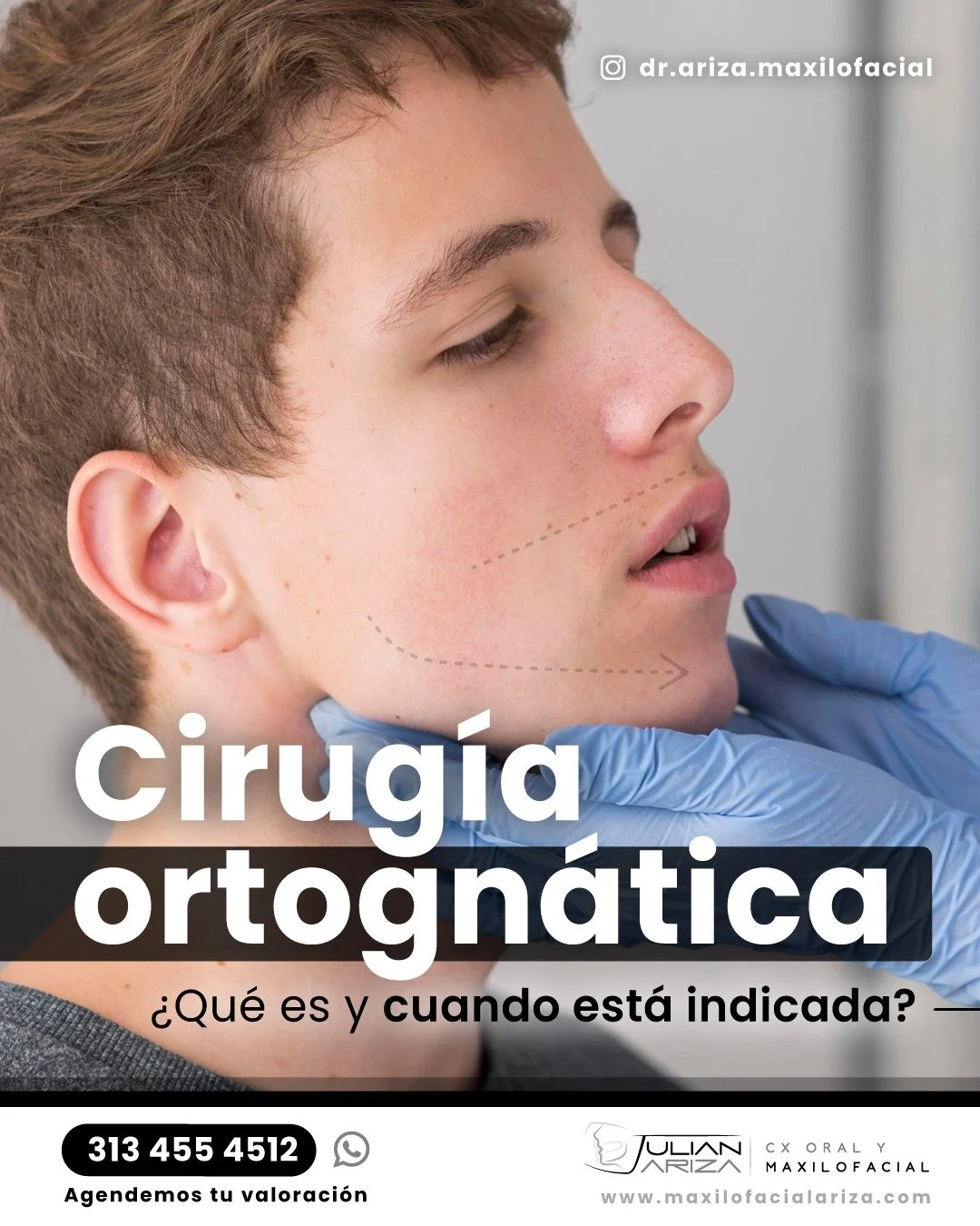 La cirug&iacute;a ortogn&aacute;tica es un procedimiento quir&uacute;rgico utilizado para corregir problemas en el alineamiento de los huesos maxilares y la mand&iacute;bula.
Esta cirug&iacute;a se realiza con el objetivo de corregir deformidades esq