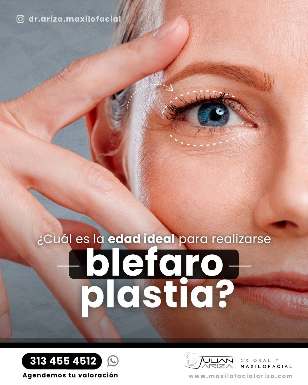La blefaroplastia est&aacute; indicada en las personas que quieren rejuvenecer su mirada y evitar el aspecto de cansancio que dan el exceso de piel y los dep&oacute;sitos de grasa en los p&aacute;rpados. Aunque puede realizarse a cualquier edad, suel