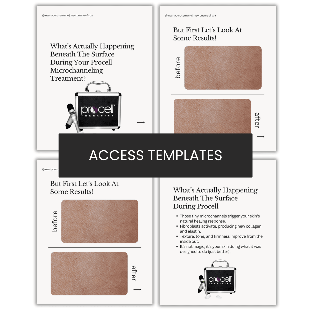 What's Happening During Procell Microchanneling Carousel