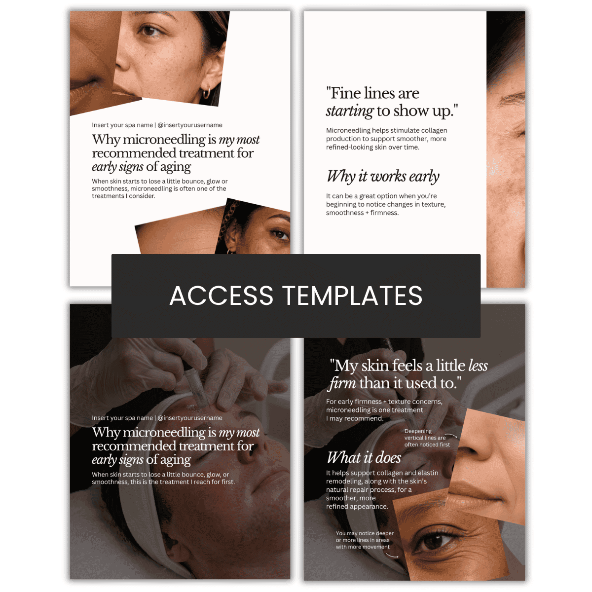 Why microneedling is my most recommended treatment for early signs of aging Carousel