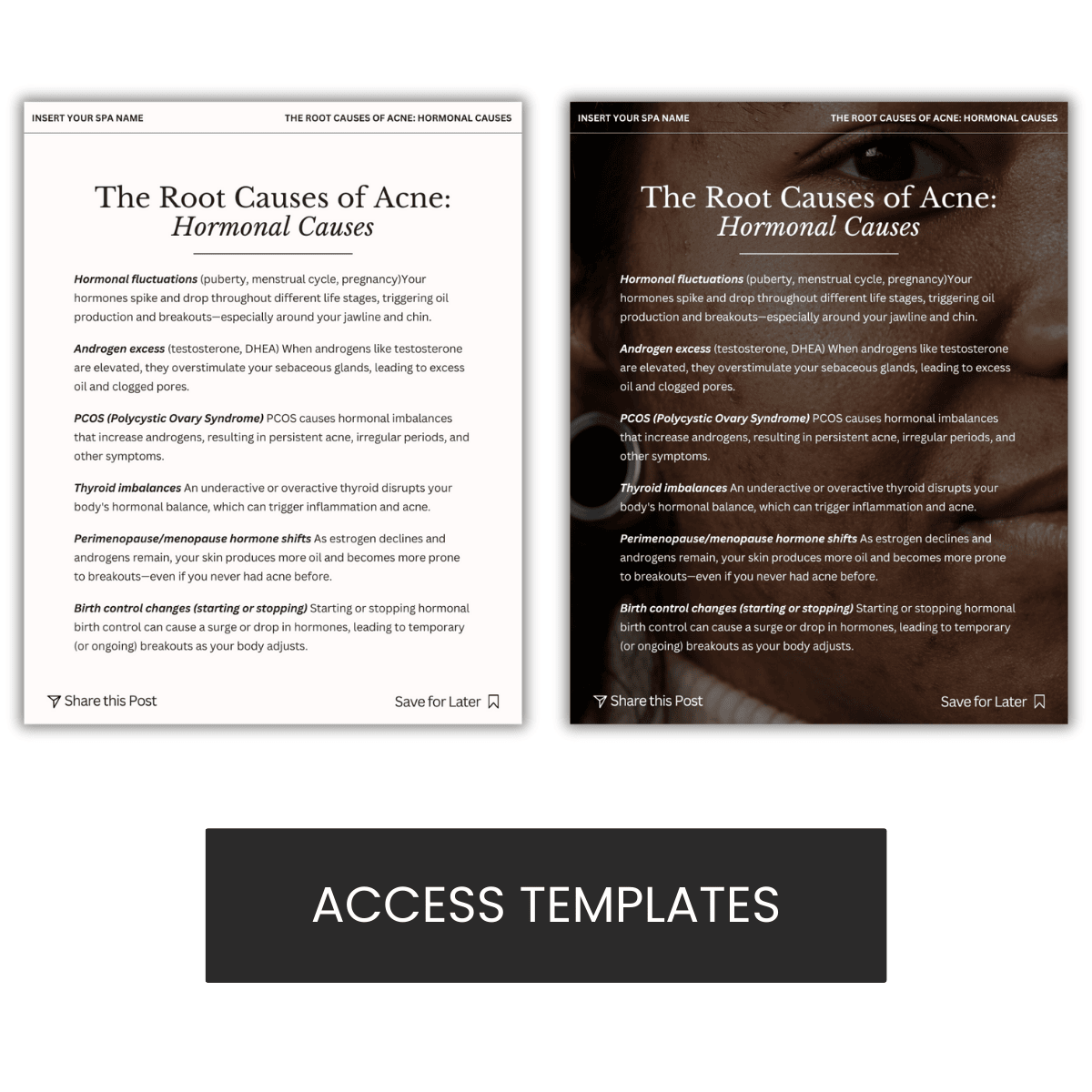 The Root Causes of Acne Hormonal Causes Graphic