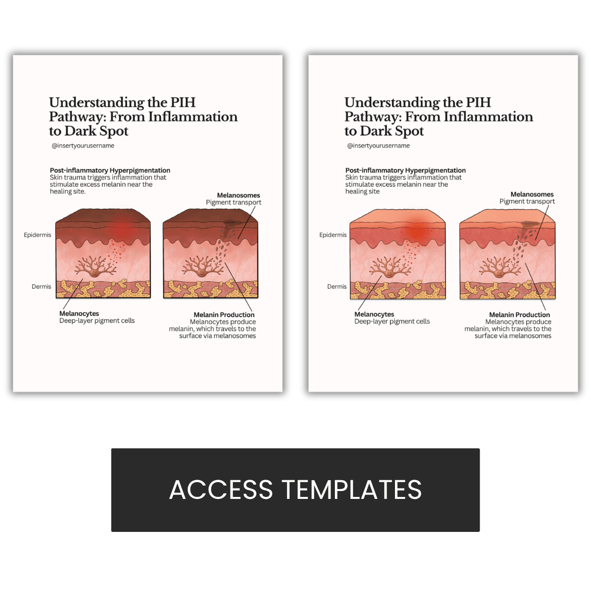 PIH & Dark Spot Inflammation Illustration