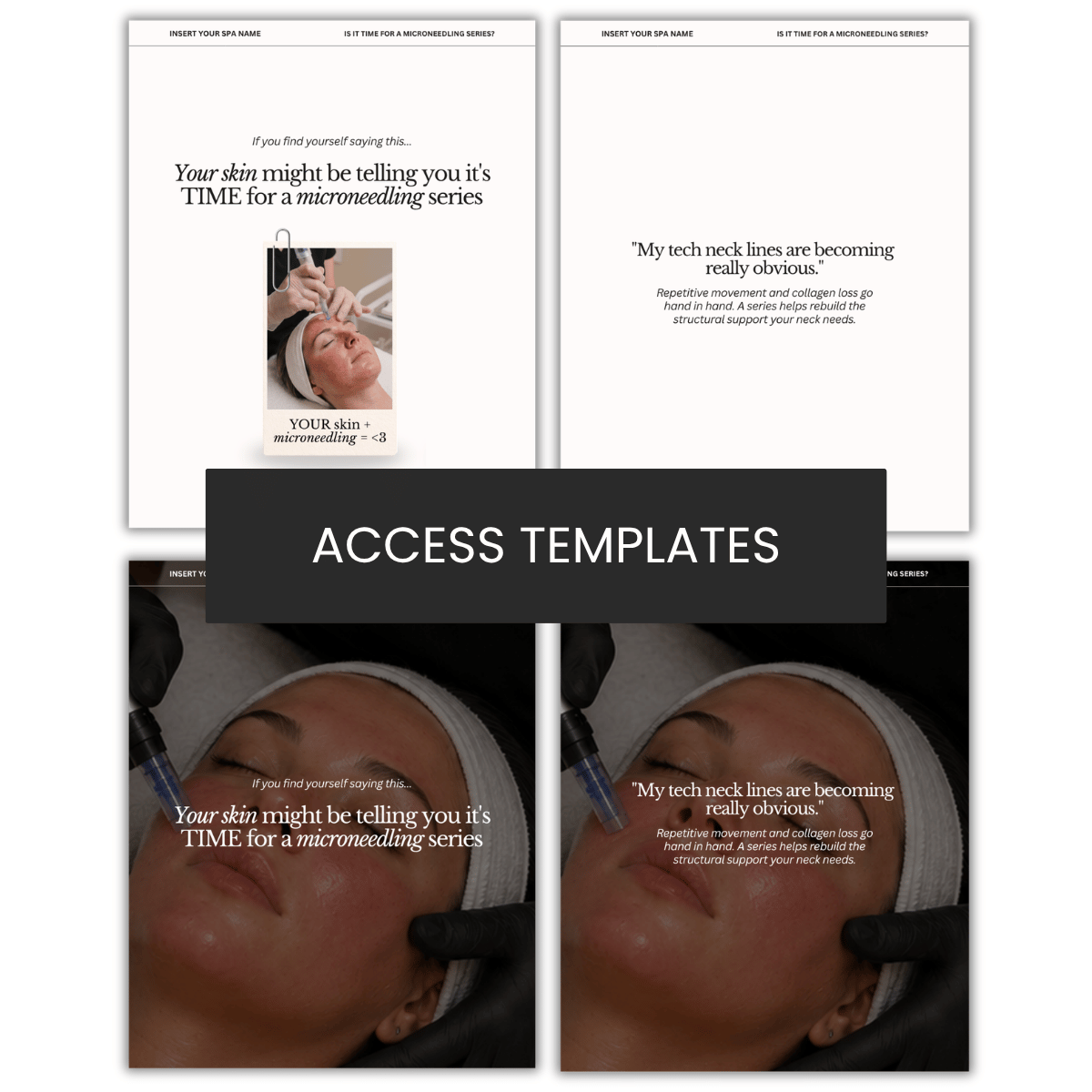 Your skin might be telling you it's TIME for a microneedling series Carousel