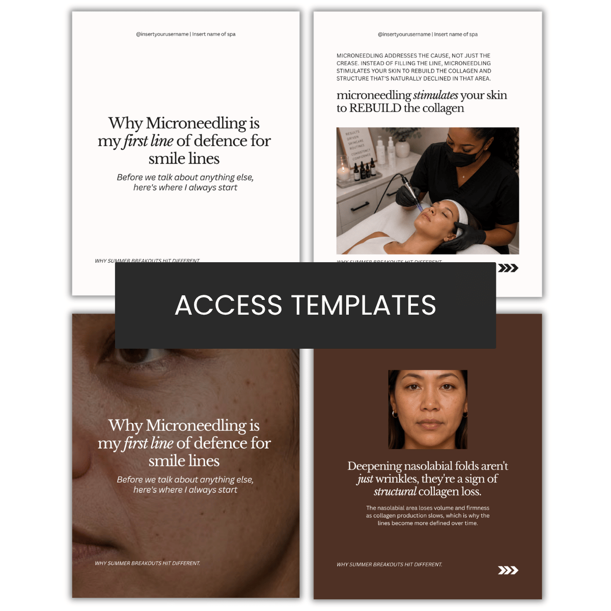 Why Microneedling is my first line of defense for smile lines Carousel