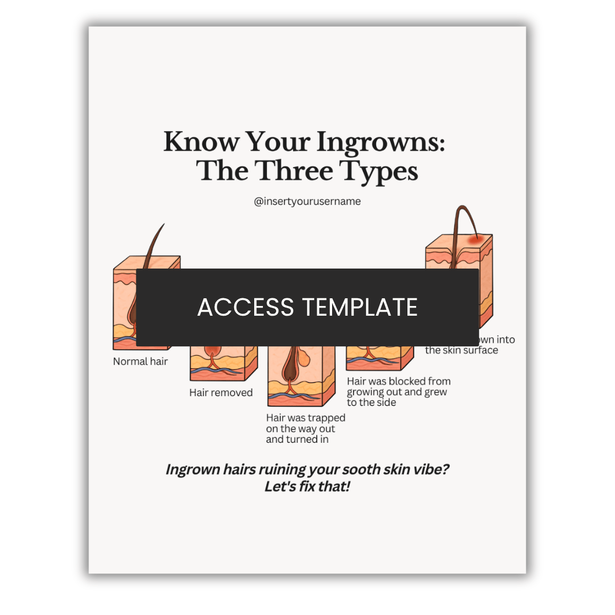Know Your Ingrowns Illustration