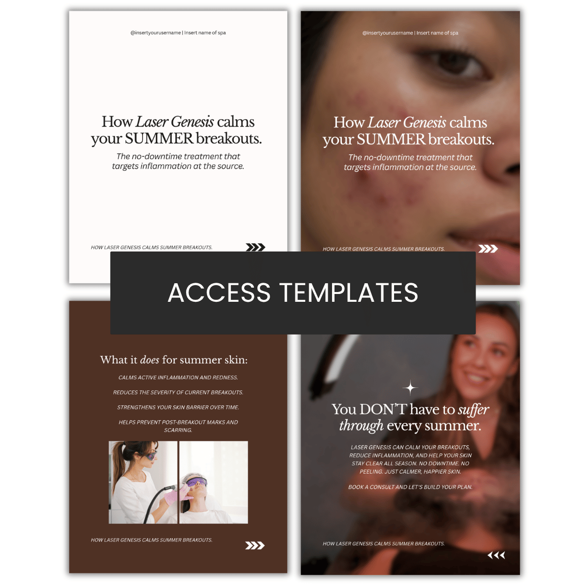 How Laser Genesis can help calm your SUMMER breakouts Carousel
