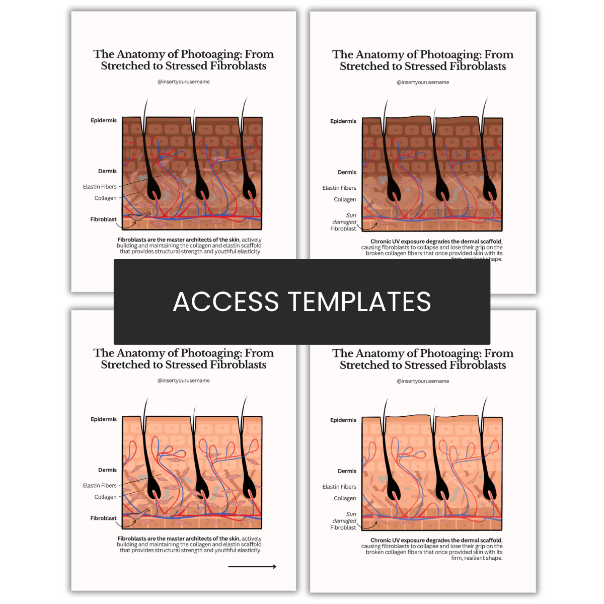 The Anatomy of Photoaging: From Stretched to Stressed Fibroblasts Illustration
