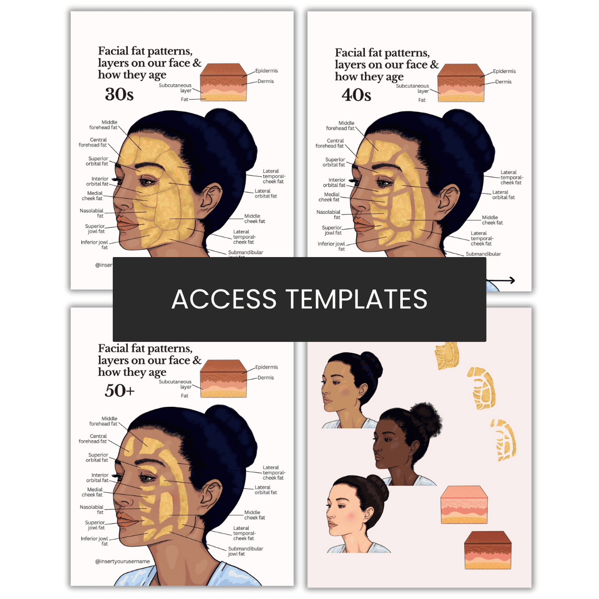 Facial Fat Aging Illustration