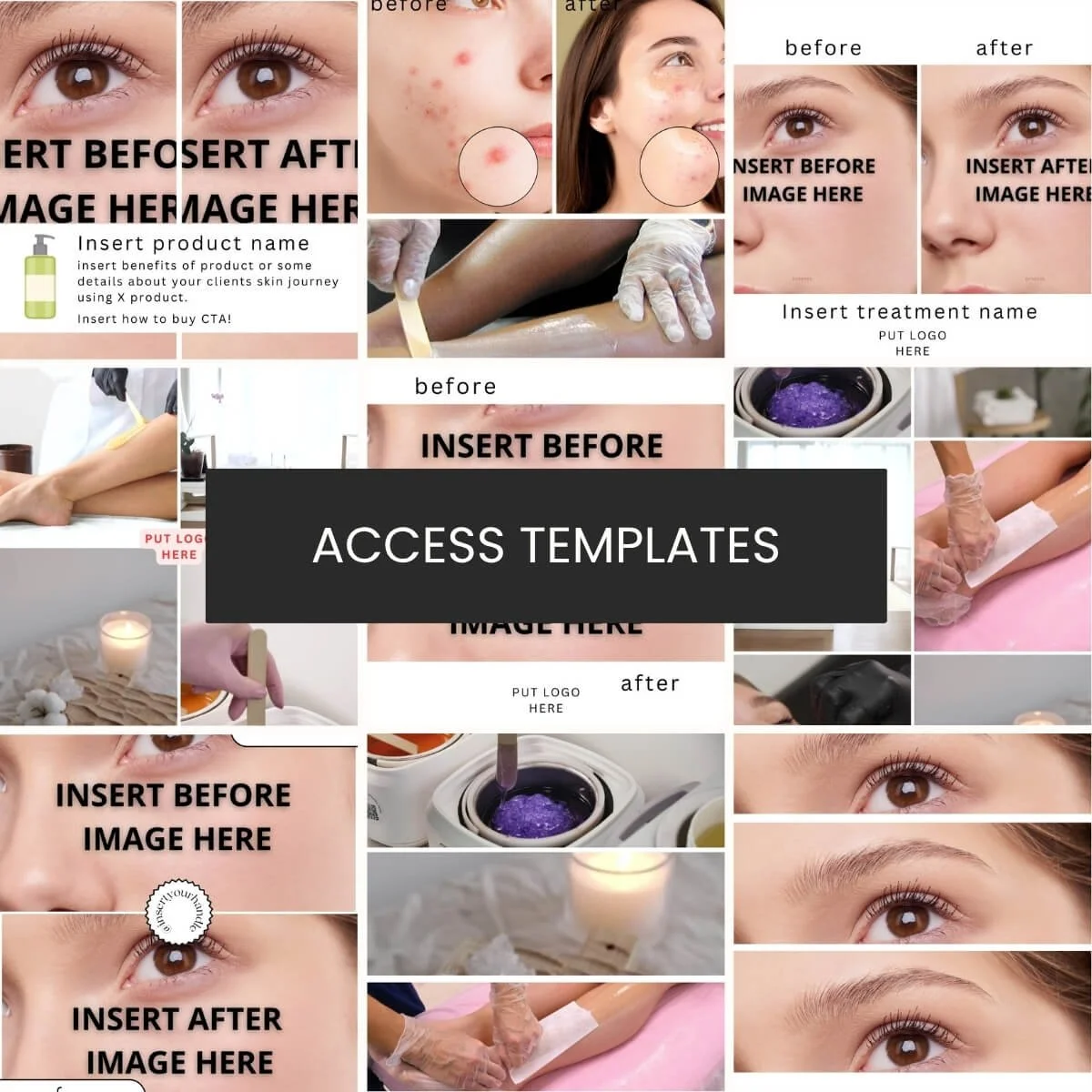 Before and After Template Collection