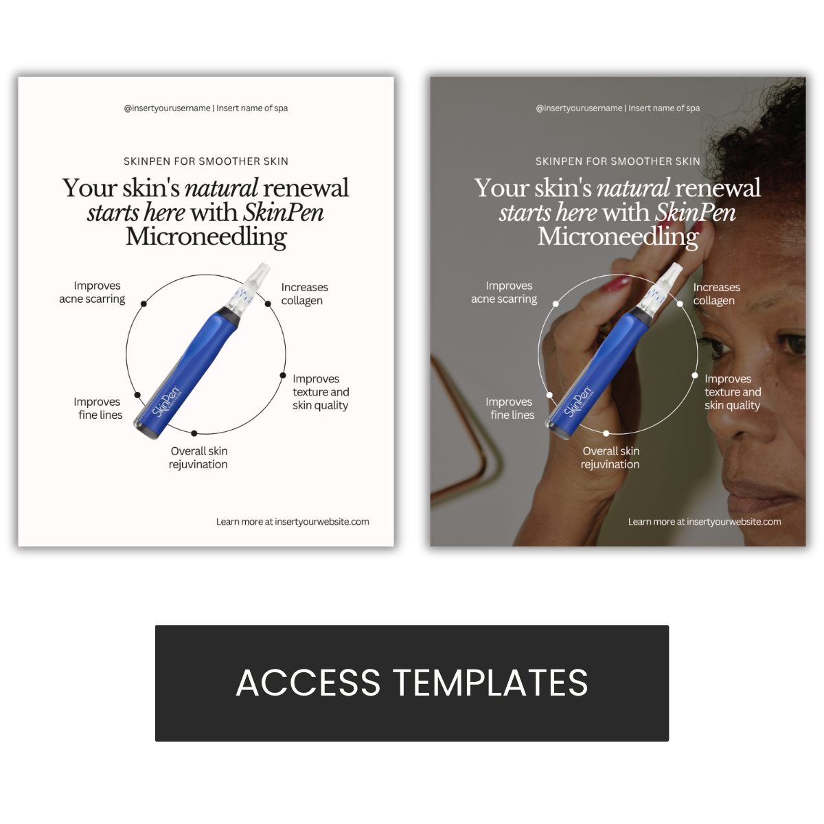 SkinPen Graphic