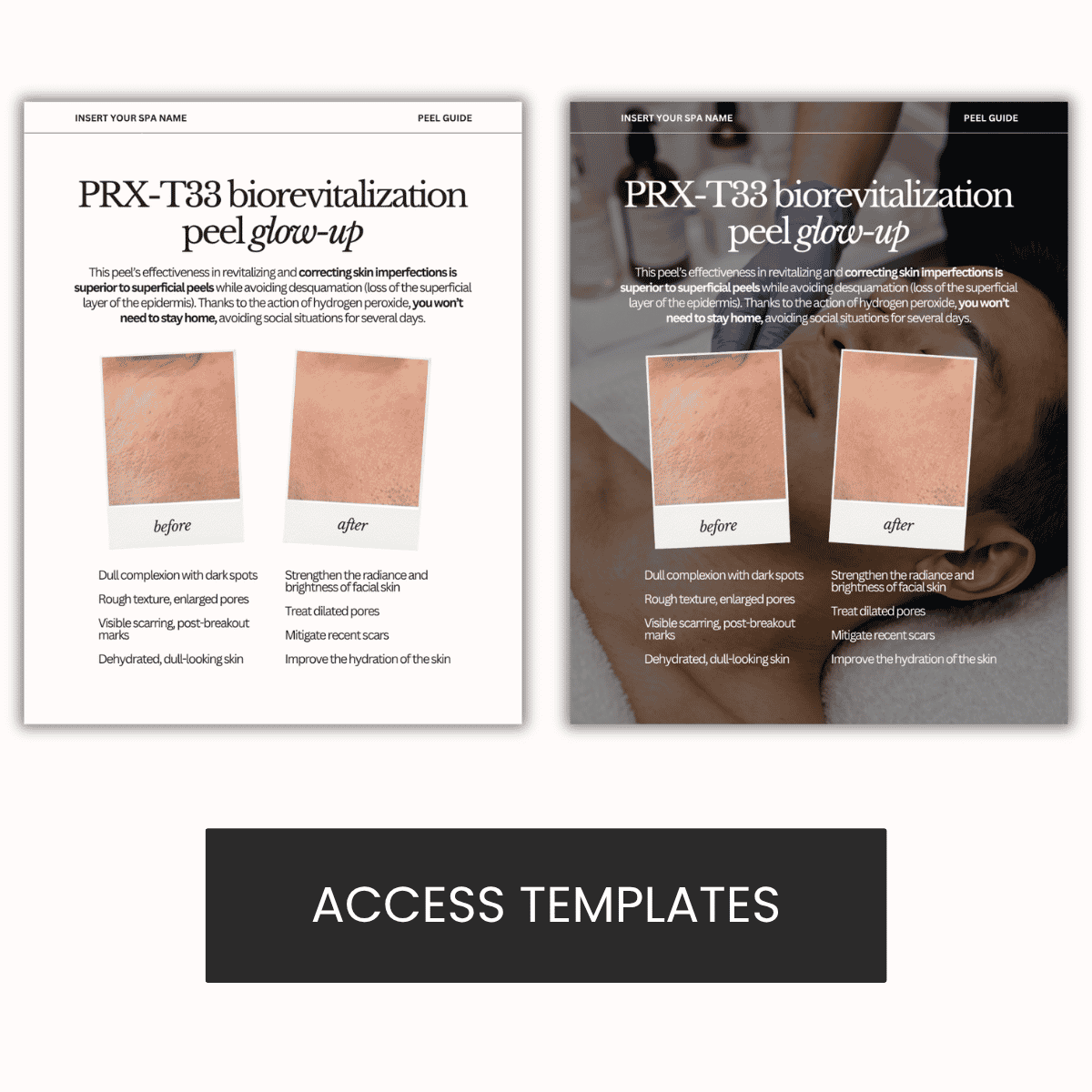 PRX-T33 biorevitalization peel glow-up Graphic