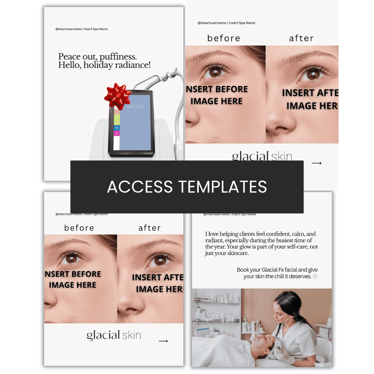 Glacial fx Holiday Carousel | Holiday Puffiness