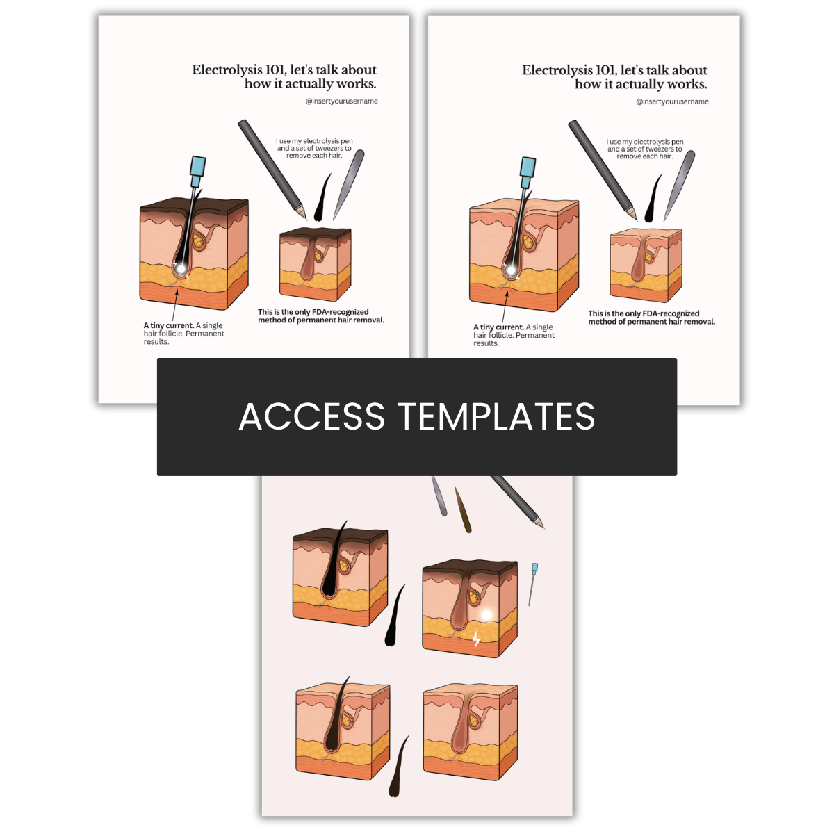Electrolysis Illustration