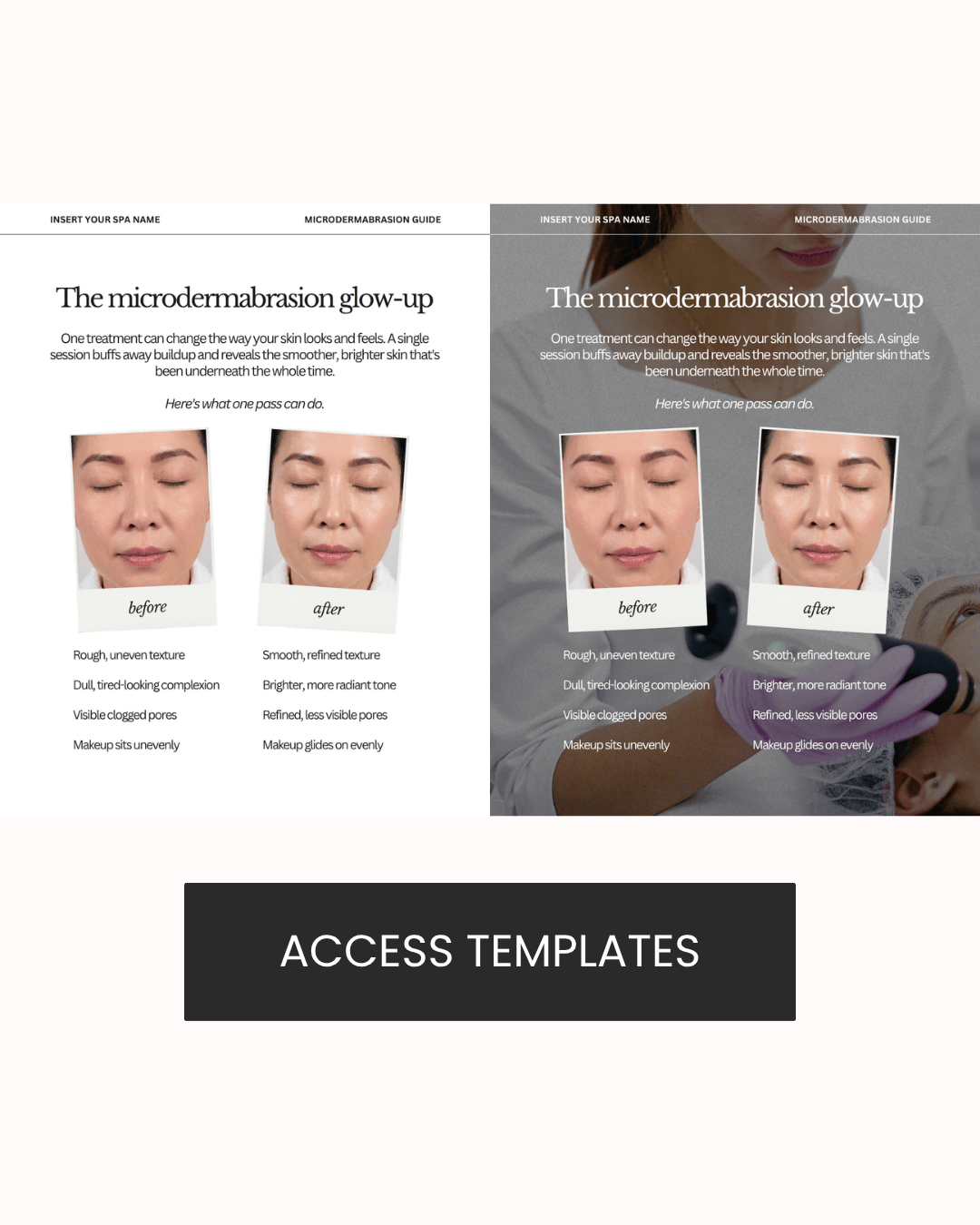 The microdermabrasion glow-up Graphic