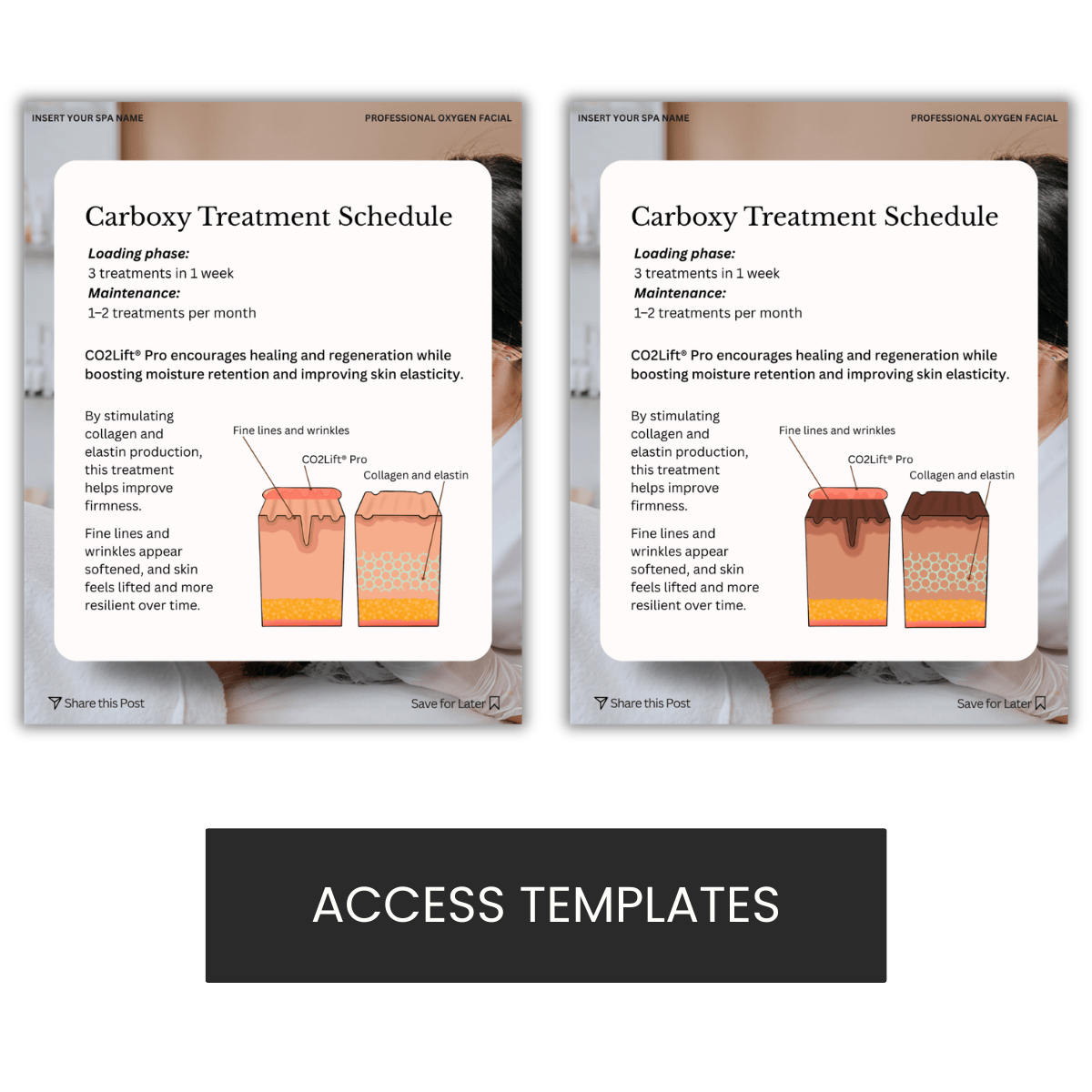 Carboxy Treatment Schedule CO2 Carboxy Therapy Graphic