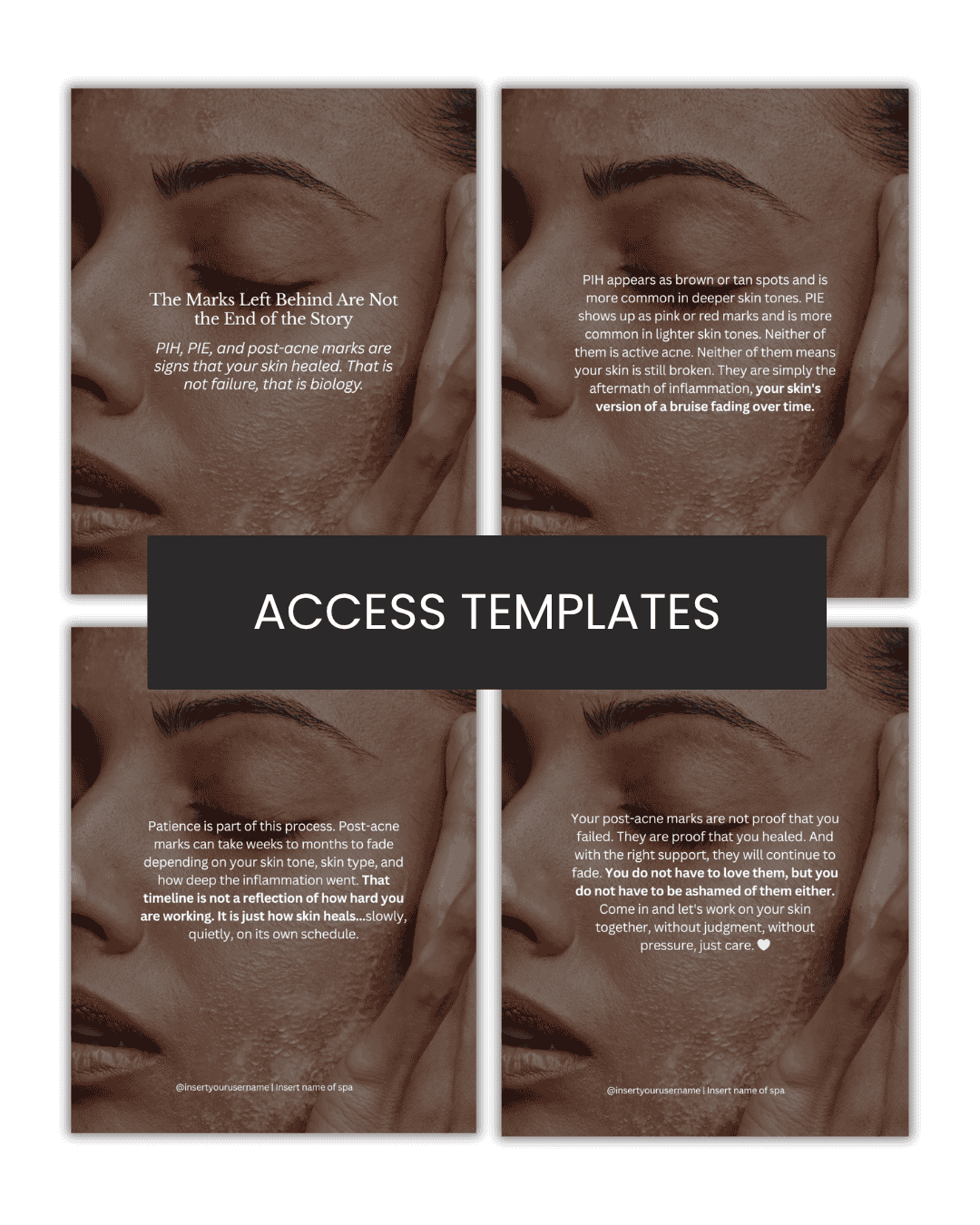 The Marks Left Behind Are Not the End of the Story Carousel