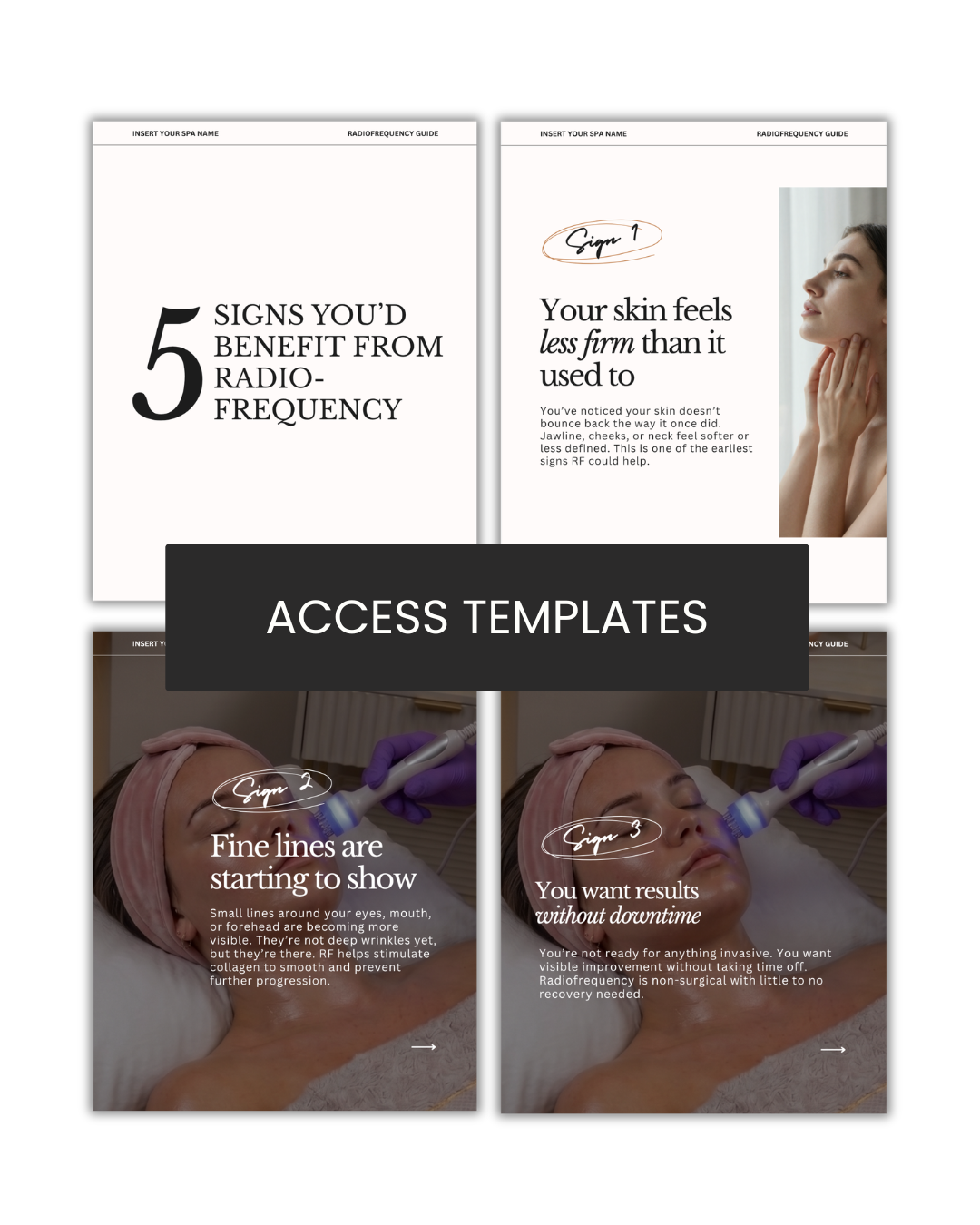 5 Signs you'd benefit from radiofrequency Carousel