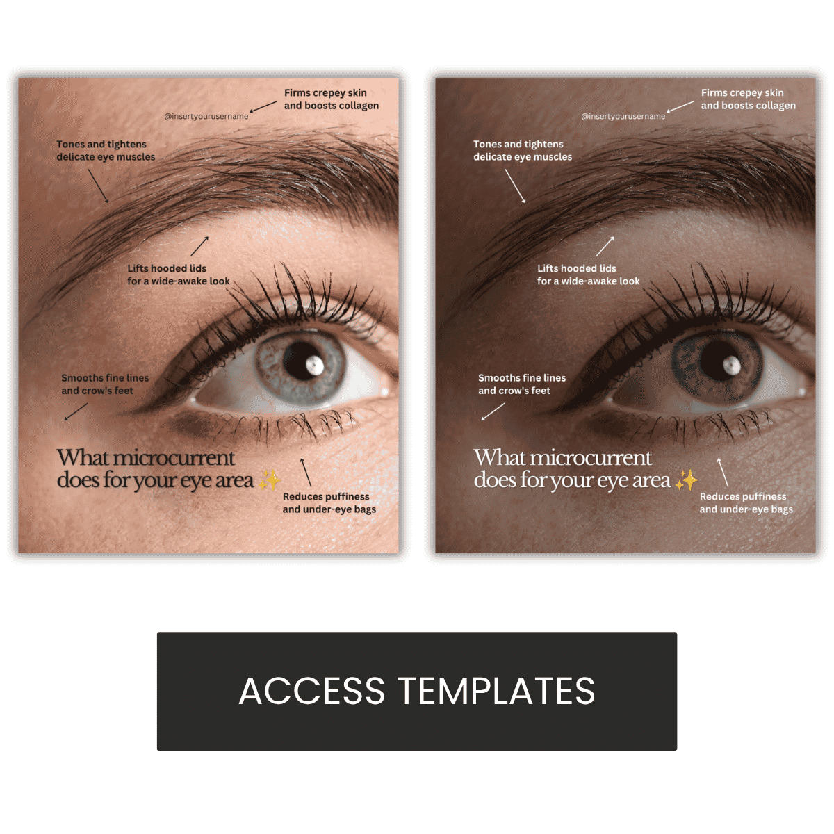 What Microcurrent Does for Your Eye Area Graphic