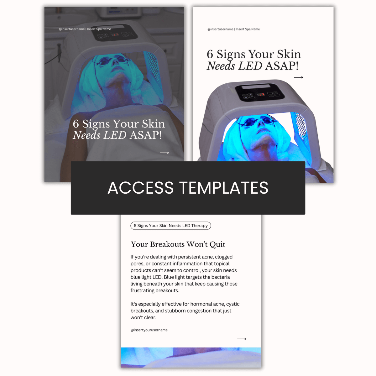 6 Signs Your Skin Needs LED Therapy ASAP Carousel