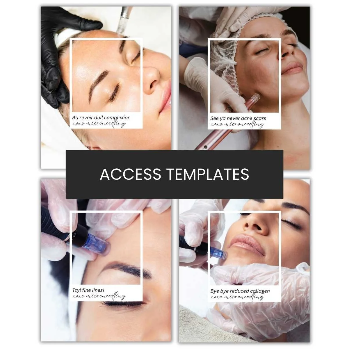 Microneedling "Goodbye Skin Concerns" Carousel