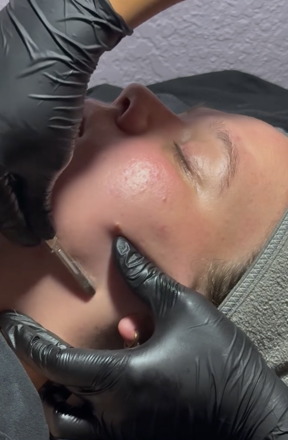 Person receiving facial treatment from a technician wearing black gloves