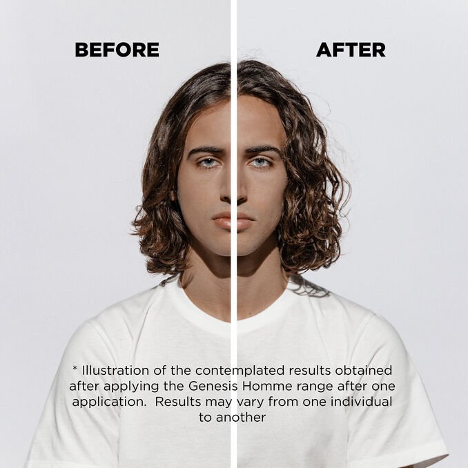 GENESISHOMME_MONTAGEFRONTDISCLAIMER_BEFOREAFTER (1).jpg