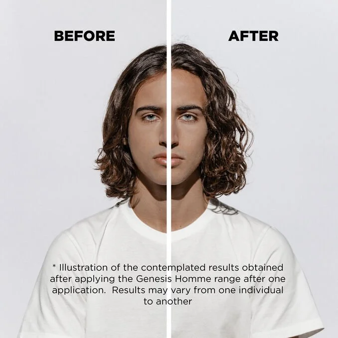GENESISHOMME_MONTAGEFRONTDISCLAIMER_BEFOREAFTER (1).jpg