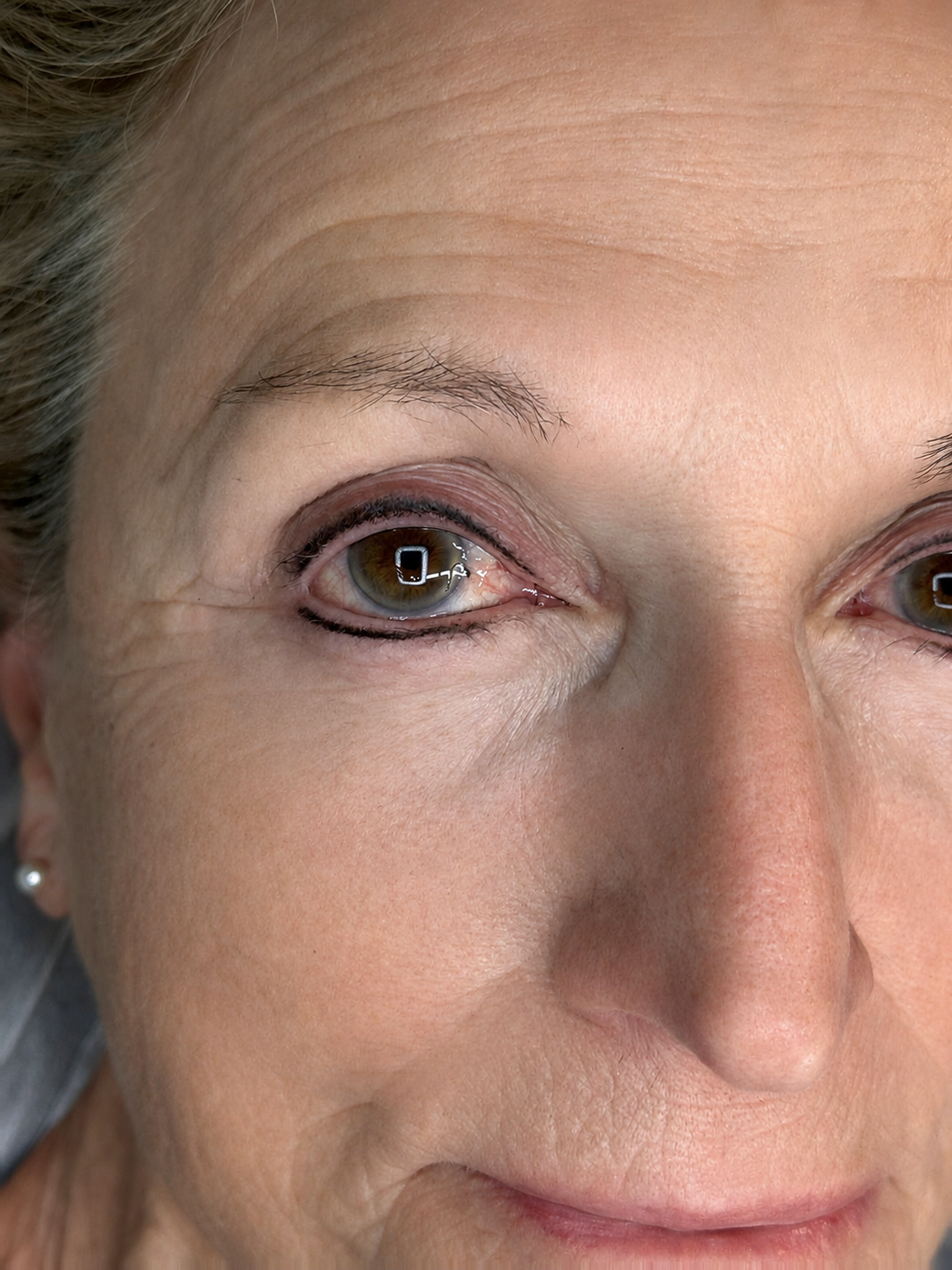 LASH LINE ENHANCEMENT