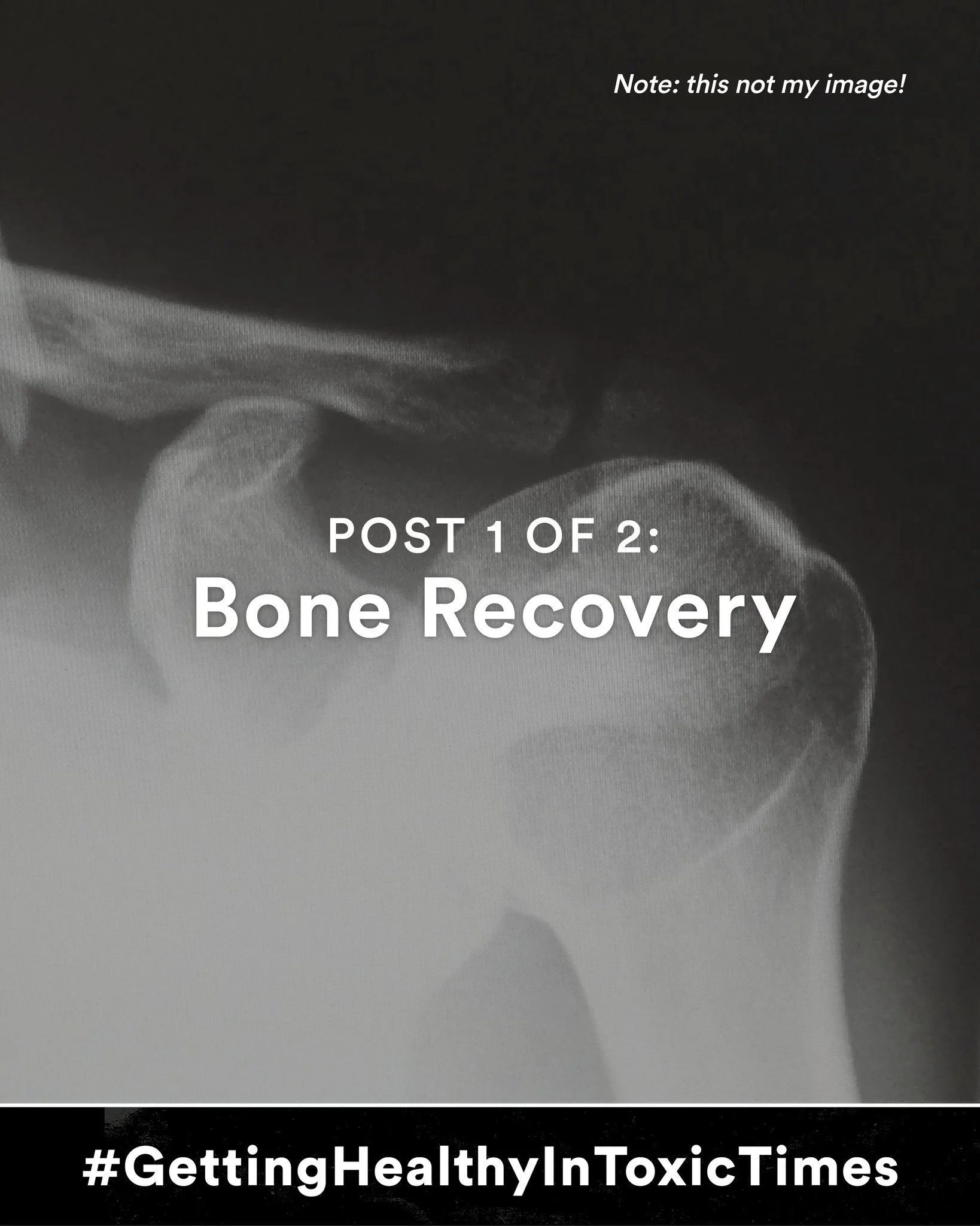 Break a bone?

Which kind of medicine do we need? Conventional, high tech? Alternative, natural? The answer, of course, is both. Depending on what needs fixing, but also depending on what stage of the illness/healing process you are at.

Here&rsquo;s