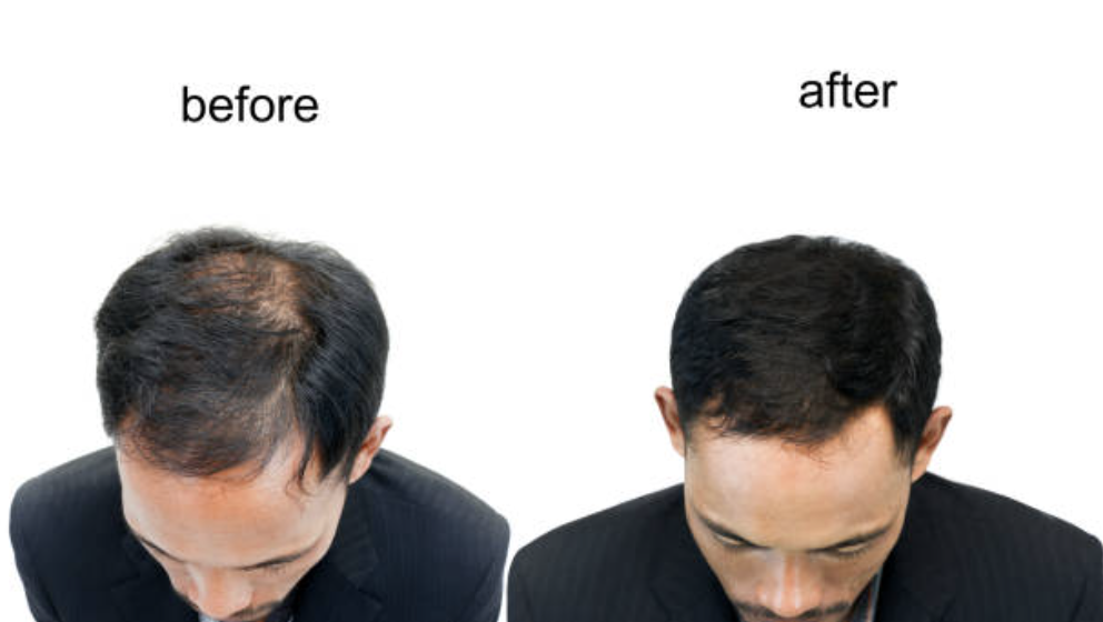 Before and after 6.png