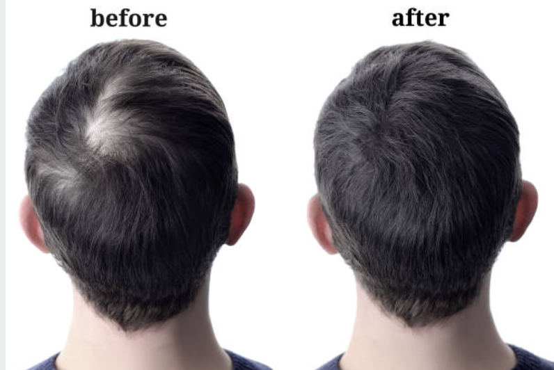 Before and after 1.png