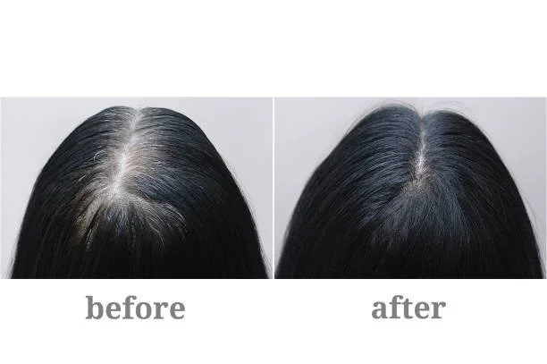 Women Hair Regrowth 9.jpg
